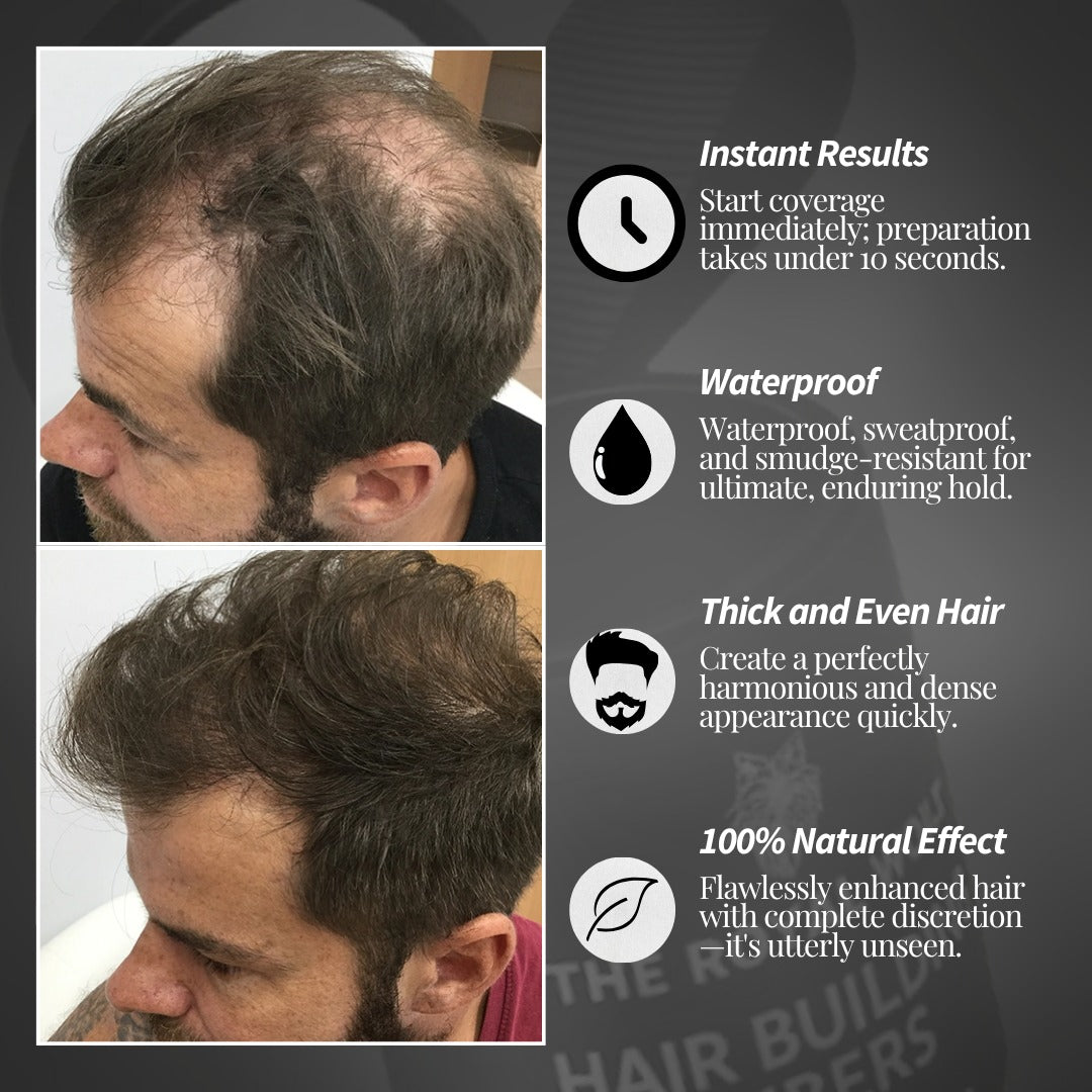 Royal Wolf Premium Hair Building Fibers